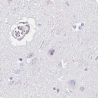 Immunohistochemical staining of human cerebral cortex using Anti-TEX44 antibody HPA049917.