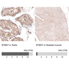 Anti-BTBD7 Antibody