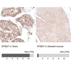 Anti-BTBD7 Antibody