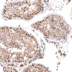 Immunohistochemical staining of human testis shows moderate to strong nuclear positivity in cells in seminiferous ducts.