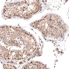 Immunohistochemical staining of human testis shows moderate to strong nuclear positivity in cells in seminiferous ducts.