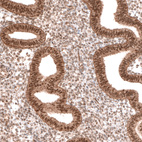 Immunohistochemical staining of human endometrium shows moderate nuclear positivity in glandular cells, as well as weaker staining in stromal cells.