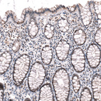 Immunohistochemical staining of human colon shows moderate to strong nuclear positivity in glandular cells.