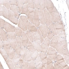 Immunohistochemical staining of human skeletal muscle shows no nuclear positivity in striated muscle fibers as expected.