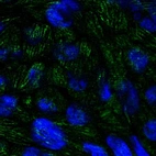Immunofluorescent staining of human cell line RT4 shows localization to focal adhesion sites.
