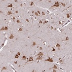 Anti-LRRC74B Antibody