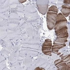 Immunohistochemical staining of human skeletal muscle shows high expression.