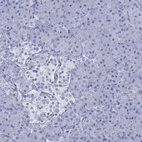 Anti-KLHL33 Antibody
