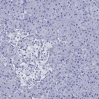 Immunohistochemical staining of human pancreas shows low expression as expected.