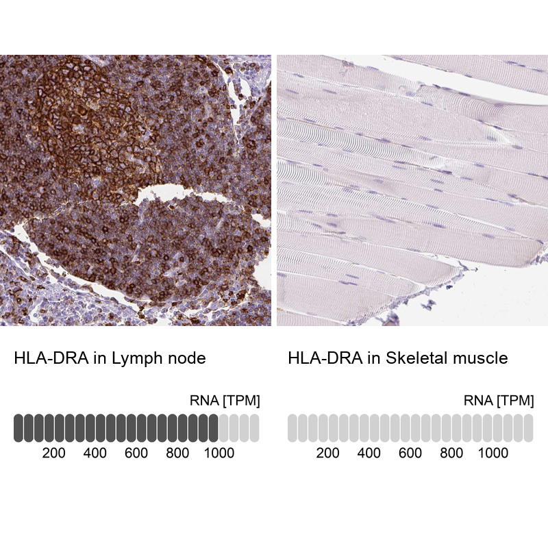 Anti-HLA-DRA Antibody