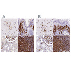 Immunohistochemical staining of human cerebral cortex, colon, kidney and lymph node using Anti-HLA-DRA antibody HPA050162 (A) shows similar protein distribution across tissues to independent antibody HPA053176 (B).