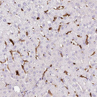 Immunohistochemical staining of human liver shows positivity in Kupffer cells.