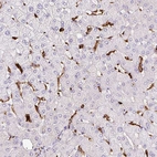 Immunohistochemical staining of human liver shows positivity in Kupffer cells.