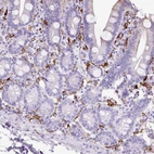 Immunohistochemical staining of human small intestine shows membranous positivity in lymphoid cells.