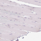 Immunohistochemical staining of human skeletal muscle shows no positivity in myocytes as expected.