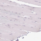 Immunohistochemical staining of human skeletal muscle shows no positivity in myocytes as expected.