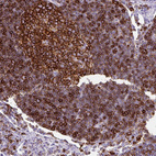 Immunohistochemical staining of human lymph node shows membranous positivity in lymphoid cells.