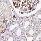 Immunohistochemical staining of human kidney using Anti-HLA-DRA antibody HPA050162.