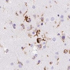 Immunohistochemical staining of human cerebral cortex using Anti-HLA-DRA antibody HPA050162.
