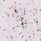 Anti-HLA-DRA Antibody