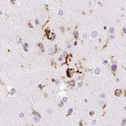 Immunohistochemical staining of human cerebral cortex using Anti-HLA-DRA antibody HPA050162.