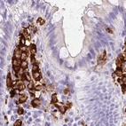 Immunohistochemical staining of human colon using Anti-HLA-DRA antibody HPA050162.