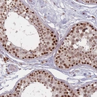 Immunohistochemical staining of human testis shows strong nuclear positivity in cells in seminiferous ducts.