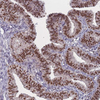 Immunohistochemical staining of human fallopian tube shows strong nuclear positivity in glandular cells.