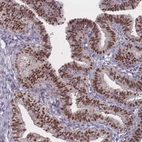 Immunohistochemical staining of human fallopian tube shows strong nuclear positivity in glandular cells.