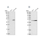 Western blot analysis using Anti-WDR18 antibody HPA050193 (A) shows similar pattern to independent antibody HPA050200 (B).