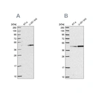 Western blot analysis using Anti-WDR18 antibody HPA050193 (A) shows similar pattern to independent antibody HPA050200 (B).