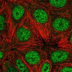 Immunofluorescent staining of human cell line MCF7 shows localization to nucleoplasm.