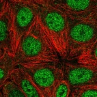 Immunofluorescent staining of human cell line MCF7 shows localization to nucleoplasm.