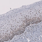 Immunohistochemical staining of human cervix, uterine shows strong nuclear positivity in squamous epithelial cells.