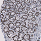 Immunohistochemical staining of human rectum shows strong nuclear positivity in glandular cells.