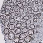 Immunohistochemical staining of human rectum shows strong nuclear positivity in glandular cells.