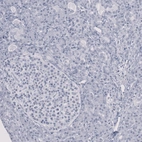 Immunohistochemical staining of human pancreas shows negative positivity in exocrine glandular cells as expected.