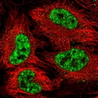 Immunofluorescent staining of human cell line HeLa shows localization to nuclear speckles.