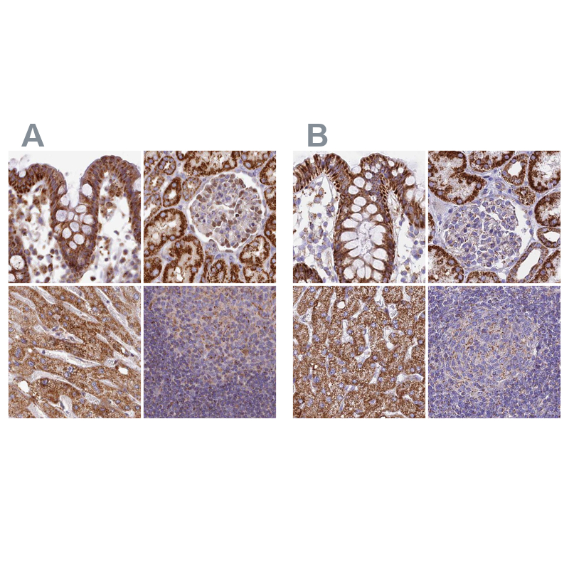 Anti-HSDL2 Antibody
