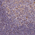 Immunohistochemical staining of human lymph node using Anti-HSDL2 antibody HPA050453.