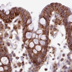 Immunohistochemical staining of human colon using Anti-HSDL2 antibody HPA050453.