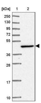 Lane 1: Marker [kDa] 250, 130, 95, 72, 55, 36, 28, 17, 10_br/_Lane 2: Human cell line RT-4