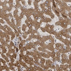 Anti-GABBR1 Antibody