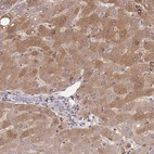 Anti-ZNF304 Antibody