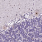 Anti-MAK16 Antibody