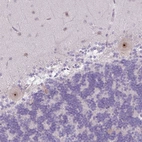 Anti-MAK16 Antibody