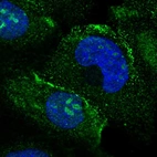 Immunofluorescent staining of human cell line A-431 shows localization to nucleoli & vesicles.