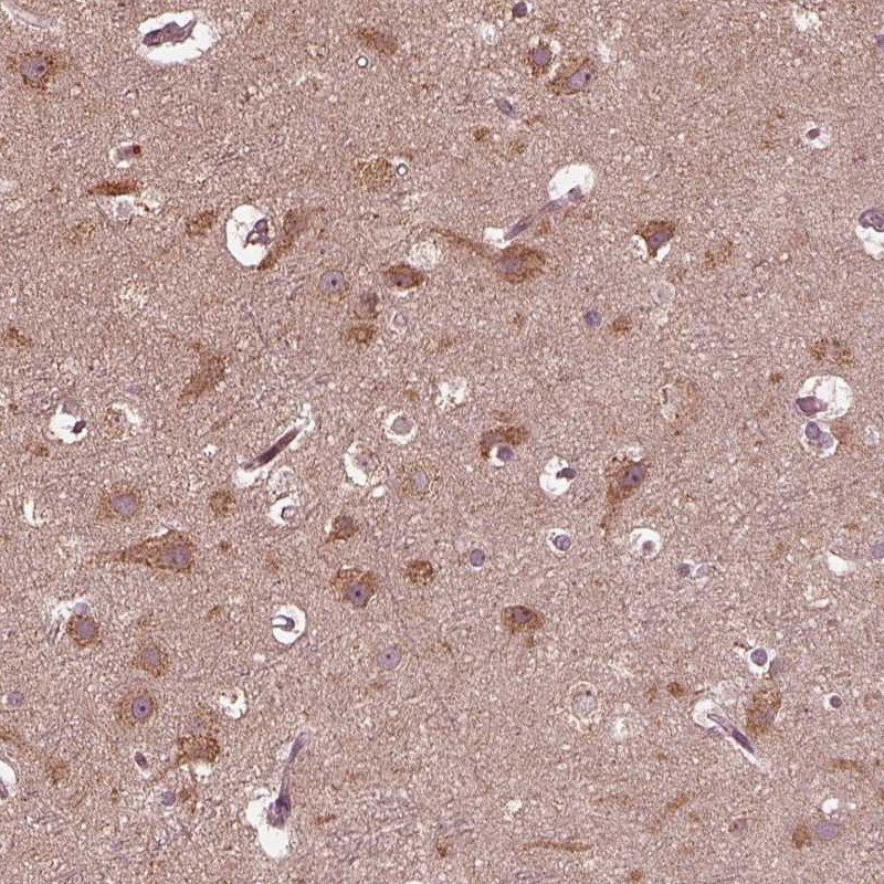 Anti-ZNF292 Antibody