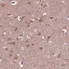 Anti-ZNF292 Antibody