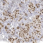Immunohistochemical staining of human pituitary gland shows moderate to strong nuclear positivity in neuroendocrine cells in the anterior lobe.